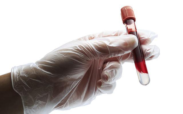 Hemoglobín v krvnom teste: označenie. Vysvetlenie krvného testu